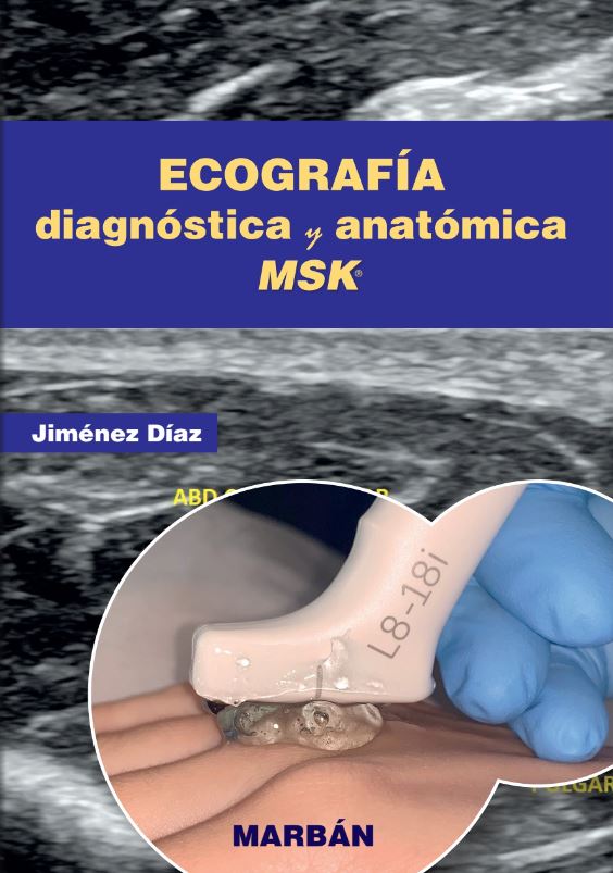 Ecografía Diagnóstica y Anatómica MSK