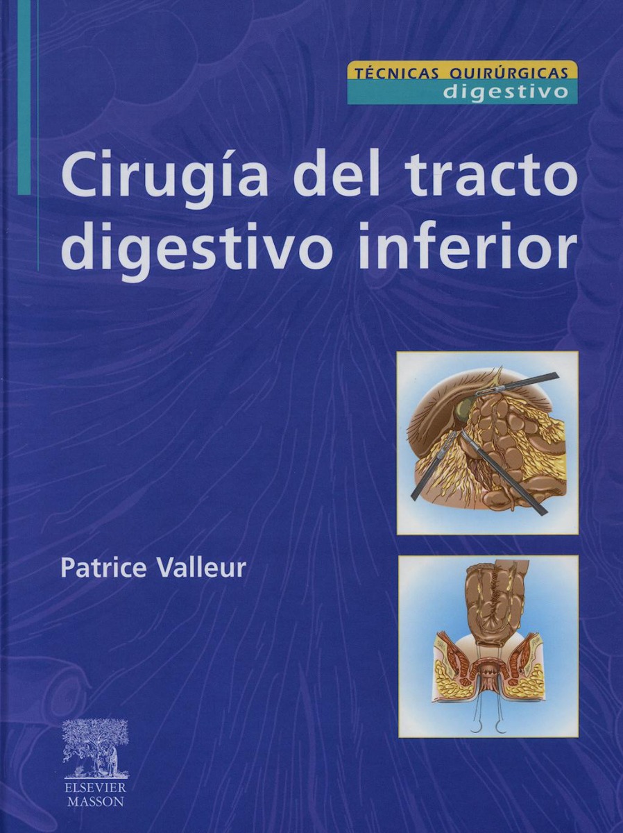 Cirugía Del Tracto Digestivo Inferior