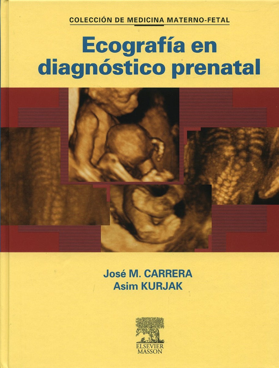 Ecografía En Diagnóstico Prenatal