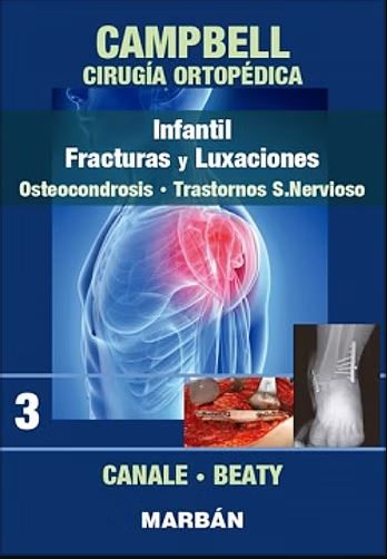 Campbell Cirugía Ortopédica, Tomo 3: Infantil. Fracturas Y Luxaciones: Osteocondrosis. Trastornos Sistema Nervioso