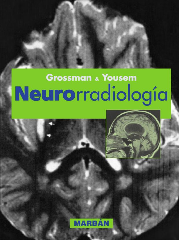 Neurorradiología