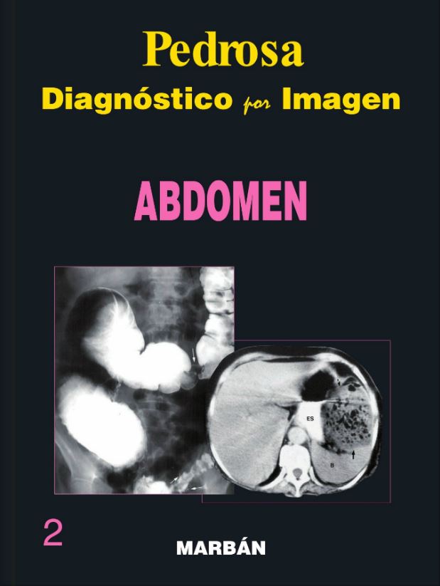 Diagnóstico por Imagen, Vol. 2 Abdomen