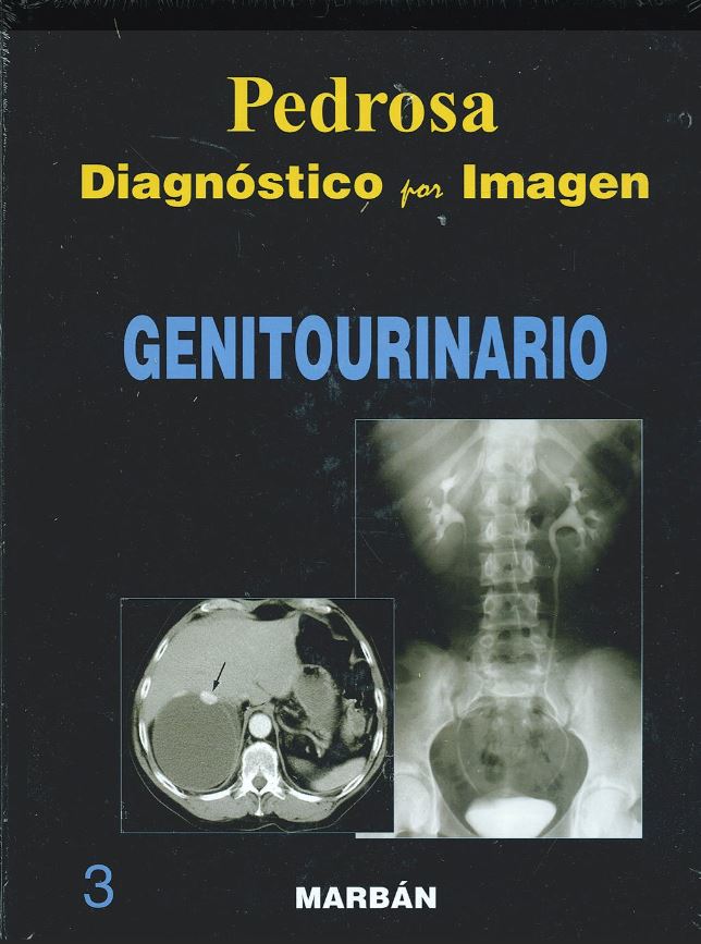 Diagnóstico Por Imagen, Vol. 3: Genitourinario