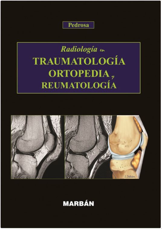Radiologia En Traumatologia, Ortopedia Y Reumatolo