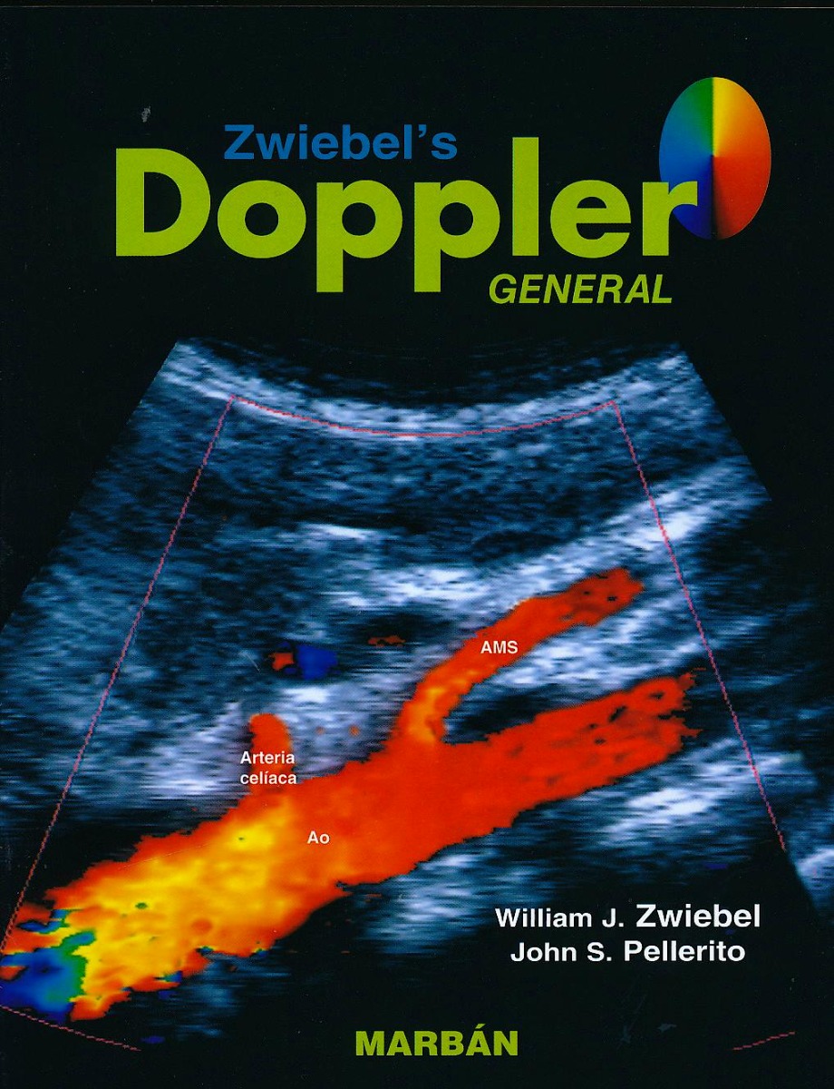 ZWIEBEL's Doppler General