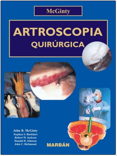 Artroscopia Quirurgica. (Tapa Rustica)