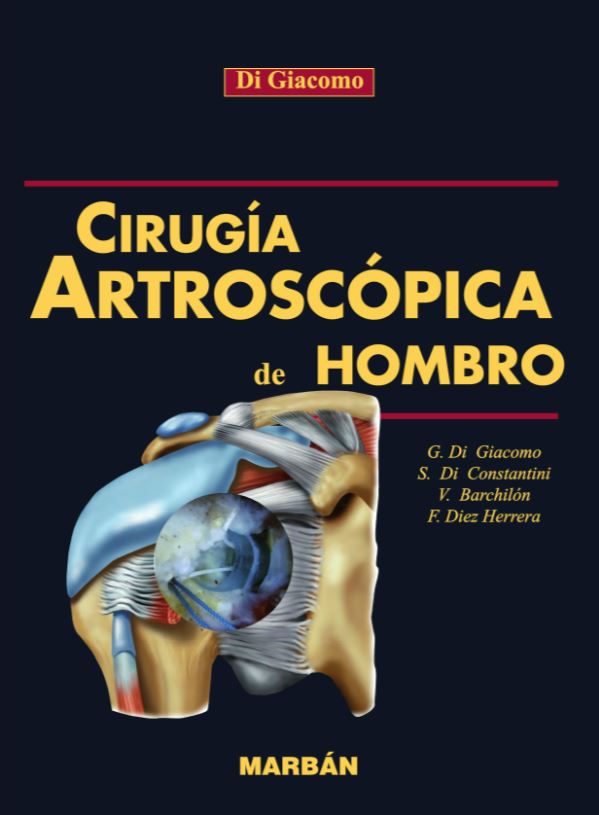 Artroscópica 
