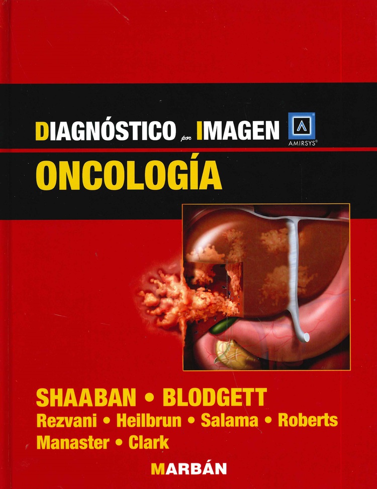 Diagnóstico por Imagen Oncología