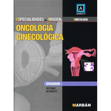 Esp En Img: Oncología Ginecológica