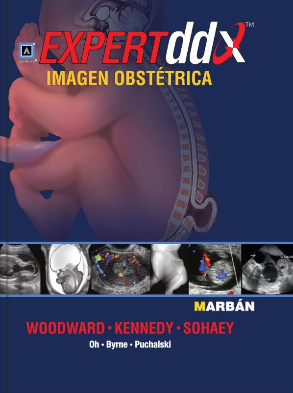 Expert Dd Imagen Obstetrica