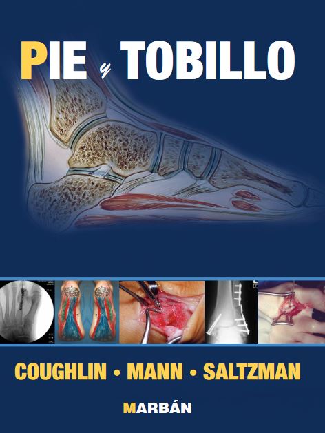 Cirugia de Pie y Tobillo