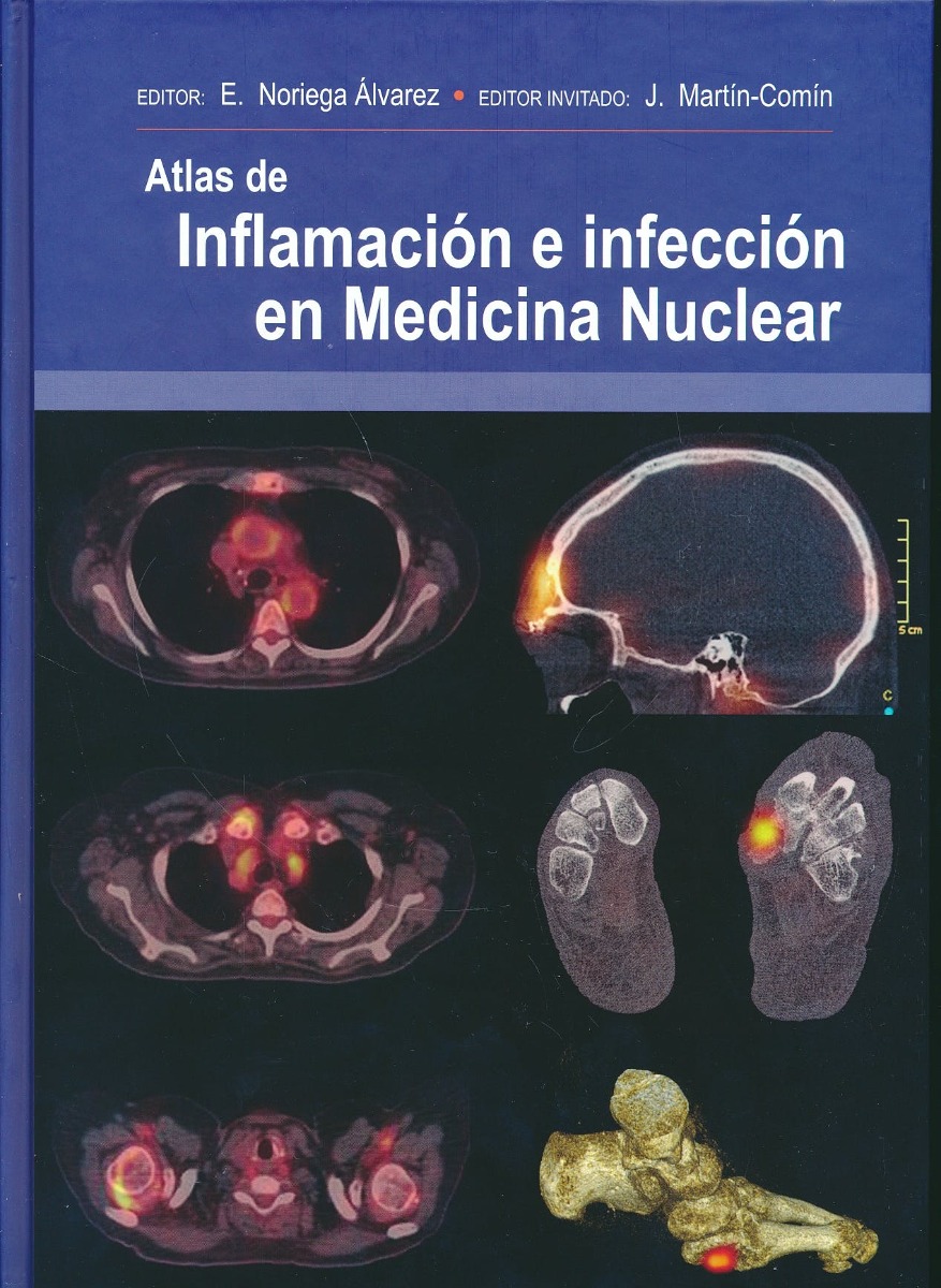 Atlas De Inflamación E Infección En Medicina Nuclear