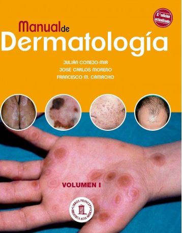 Manual De Dermatología, Tomo 1