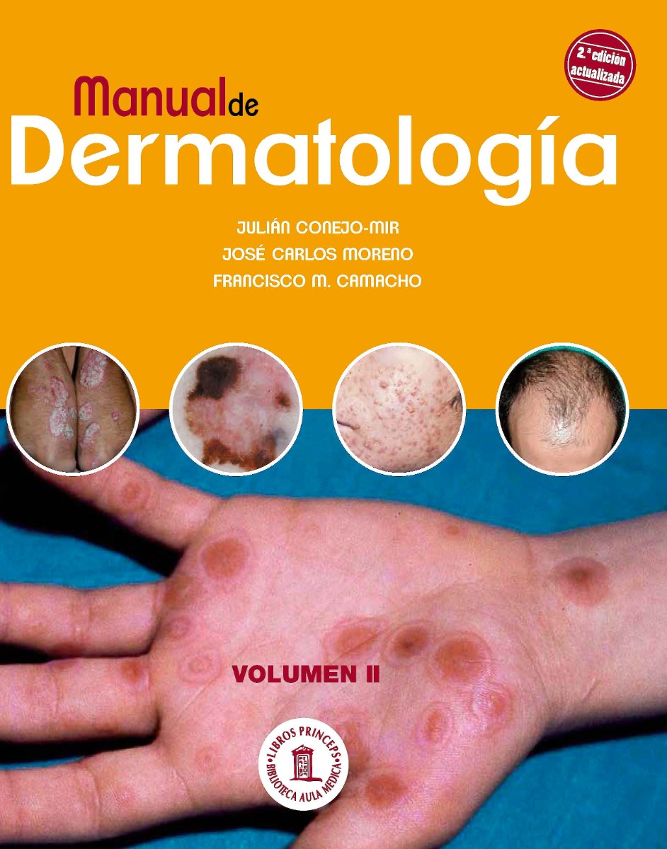 Manual De Dermatología, Tomo 2