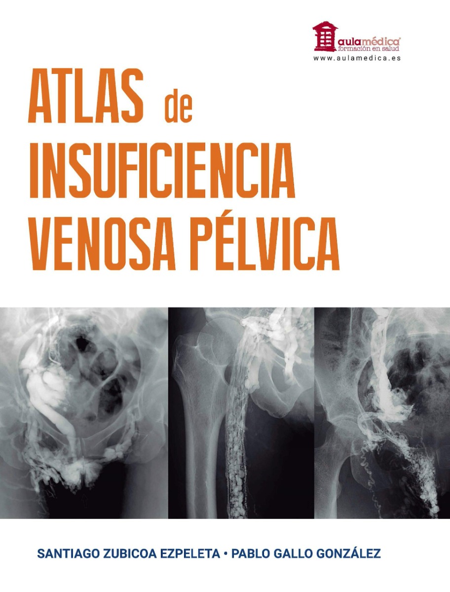 Atlas de Insuficiencia Venosa Pélvica