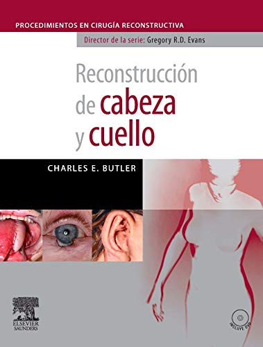 Reconstrucción De Cabeza Y Cuello