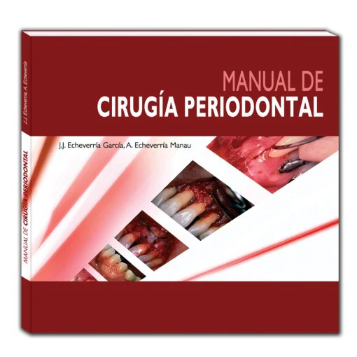 Manual de cirugía periodontal