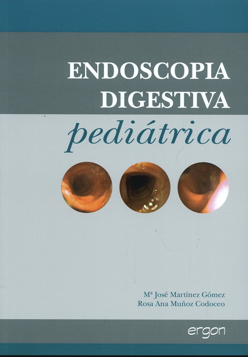 Endoscopia Digestiva Pediatrica