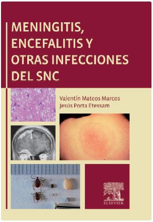 Meningitis, Encefalitis Y Otras Infecciones Del Snc