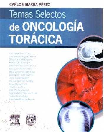 Temas Selectos De Oncologia Toracica