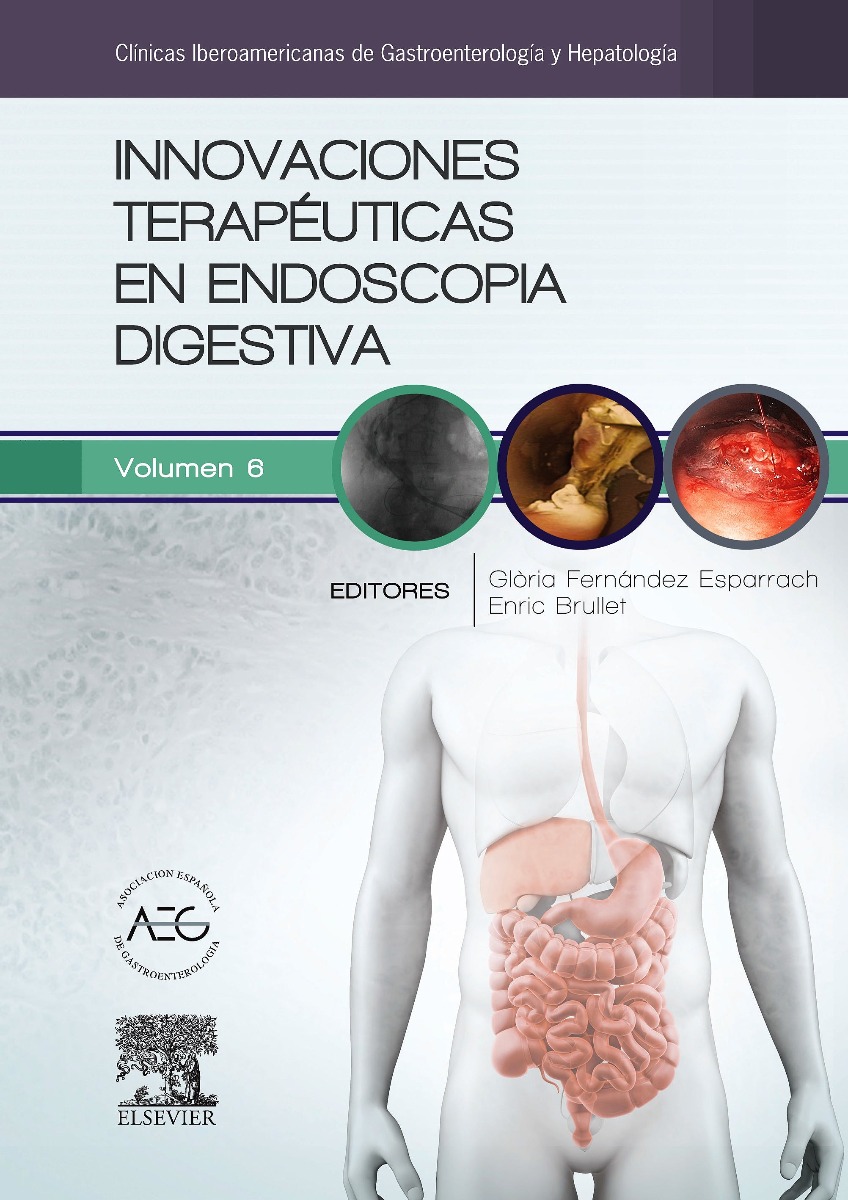 Innovaciones terapéuticas en endoscopia digestiva (clínicas iberoamericanas de gastroenterología y hepatología, vol. 6)