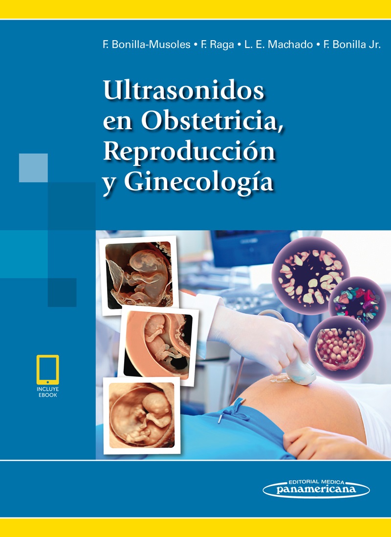 Ultrasonidos En Obstetricia Reproducción Y Ginecología Incluye Ebook