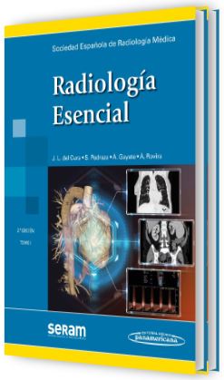 Radiología Esencial 2 Tomos