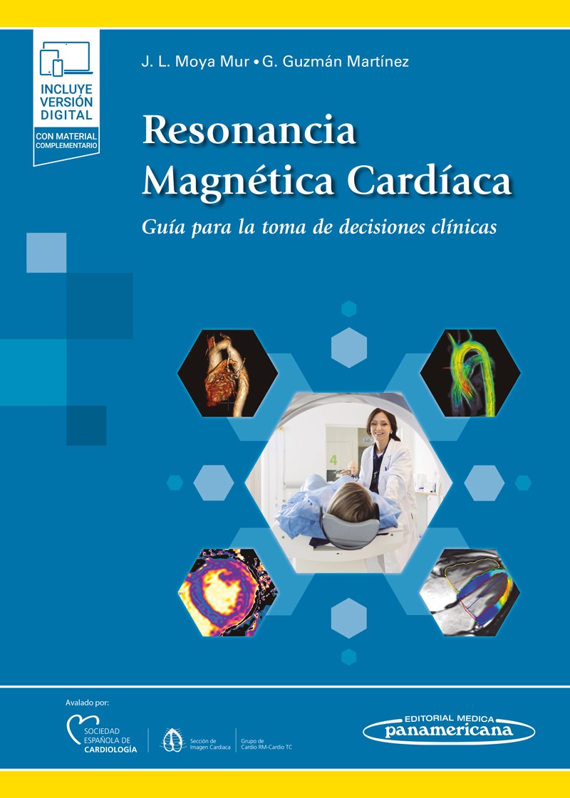 Resonancia Magnética Cardíaca Guía Para La Toma De Decisiones Clínicas
