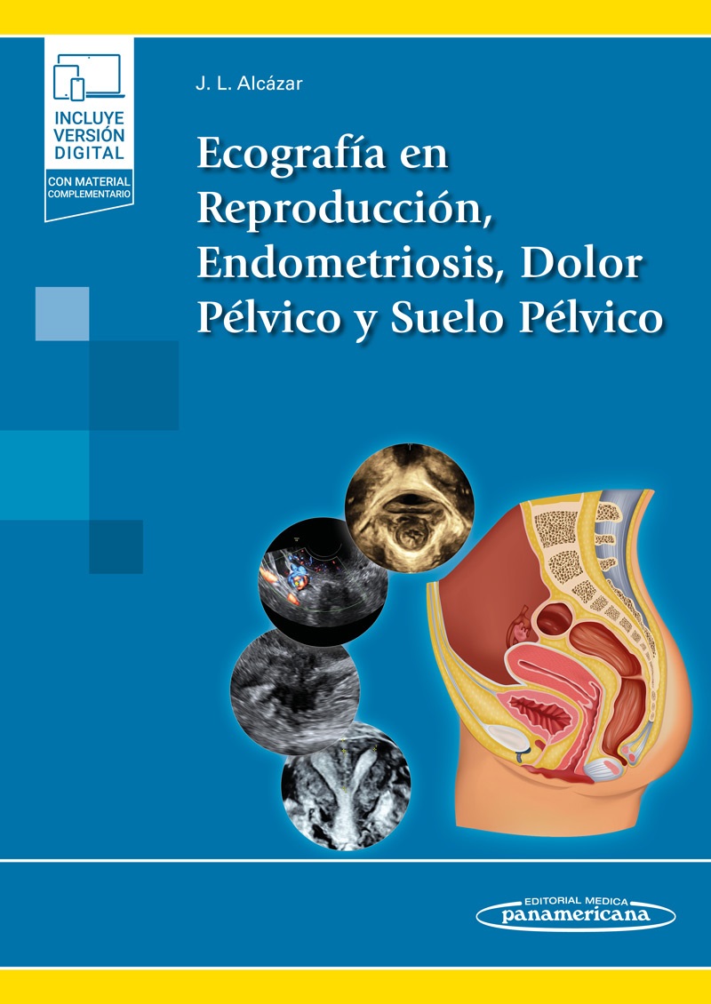 Ecografía En Reproducción Endometriosis Dolor Pélvico Y Suelo Pélvico