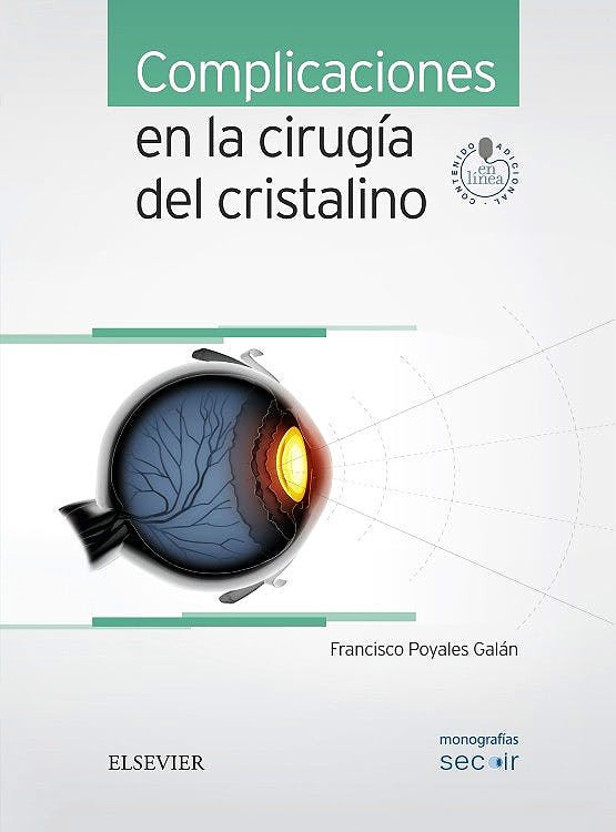 Complicaciones En La Cirugía Del Cristalino (Monografías Secoir)