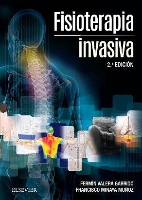Fisioterapia Invasiva . + Acceso Online