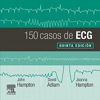 150 Casos De Ecg .