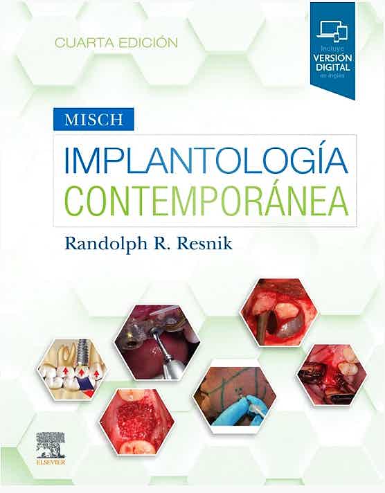 Misch Implantología Contemporánea (Incluye Versión Digital En Inglés)