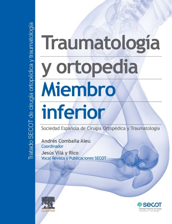 Traumatología Y Ortopedia. Miembro Inferior (Tratado Secot De Cirugía Ortopédica Y Traumatología, Tomo 3)