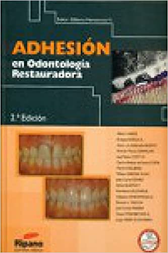 Adhesion en Odontologia Restauradora
