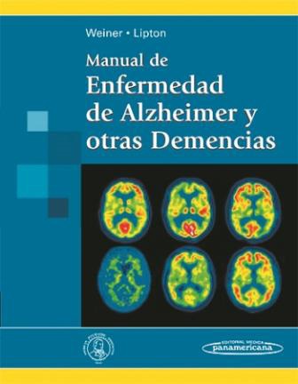 Manual De Enfermedad De Alzheimer Y Otras Demencias