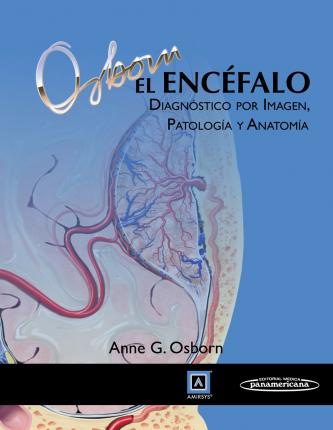 El Encéfalo Diagnóstico Por Imagen Patología Y Anatomía