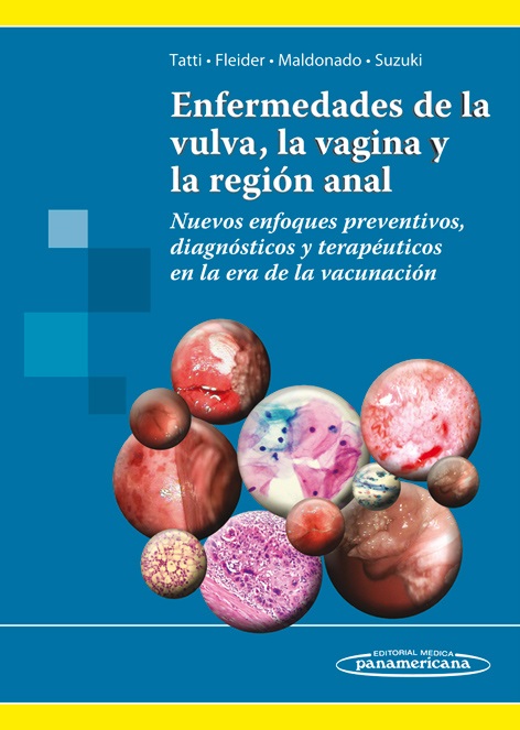 Enfermedades De La Vulva La Vagina Y La Región Anal