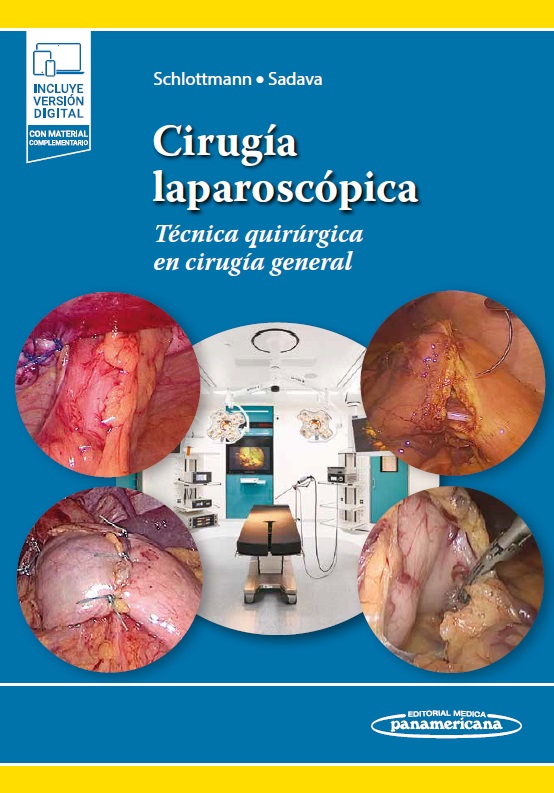 Cirugía Laparoscópica. Técnica Quirúrgica en Cirugía General