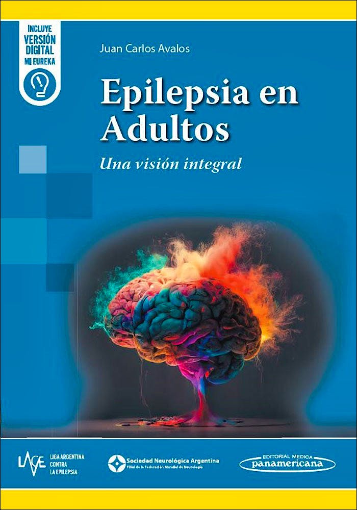 Epilepsia en Adultos. Una Visión Integral