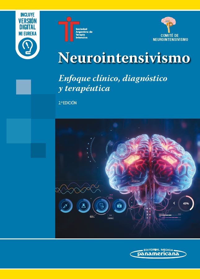 Neurointensivismo. Enfoque Clínico, Diagnóstico y Terapéutica