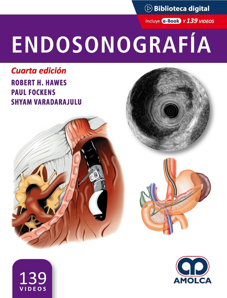 Endosonografía
