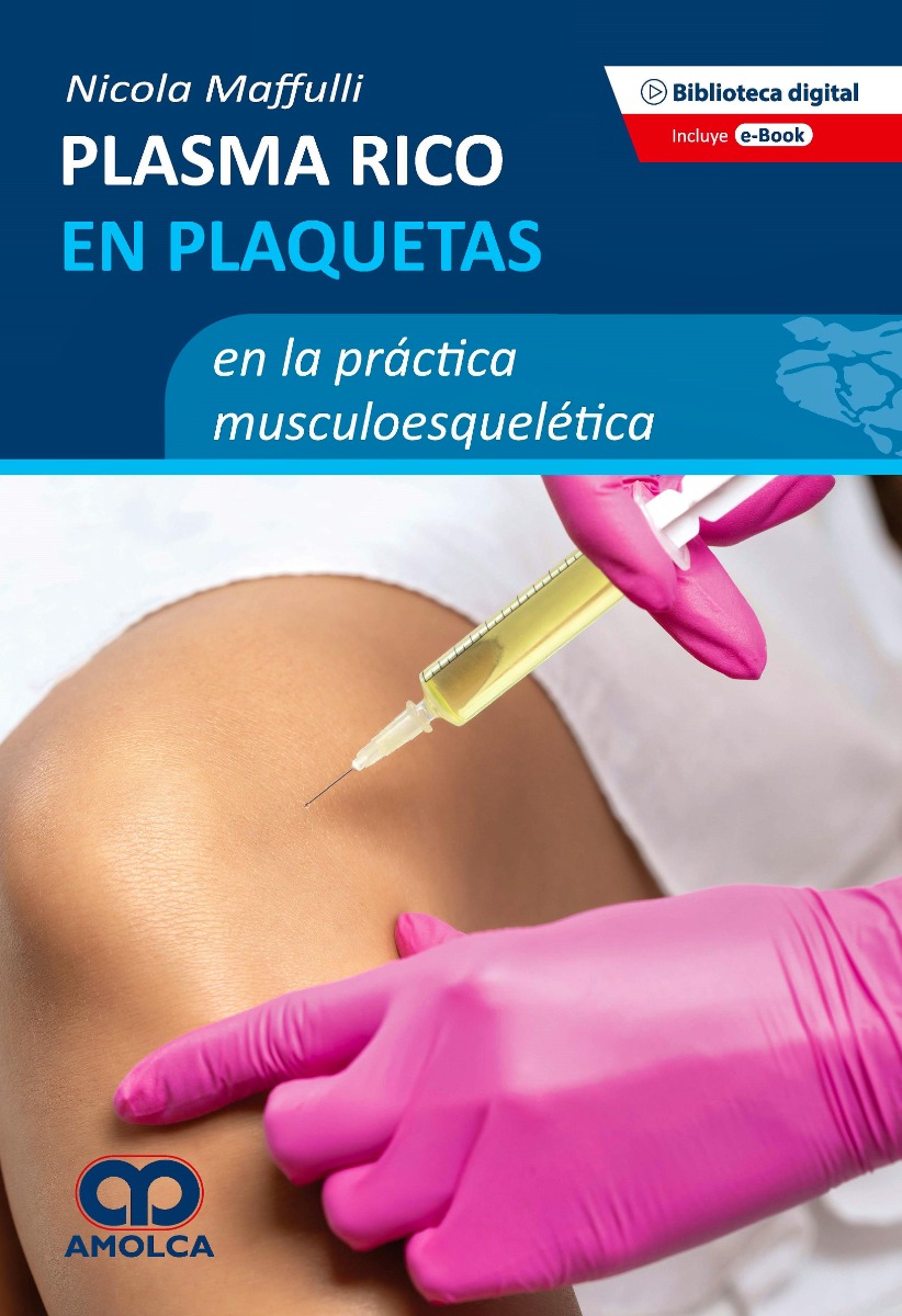 Plasma Rico en Plaquetas en la Práctica Musculoesquelética
