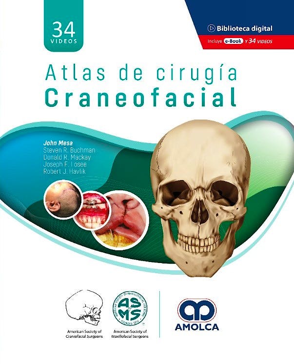 Atlas de Cirugía Craneofacial