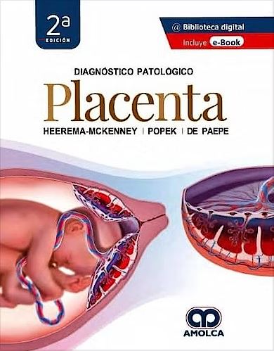 Diagnóstico Patológico. Placenta