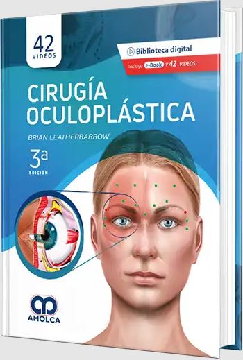 Cirugía Oculoplástica 3a Edición