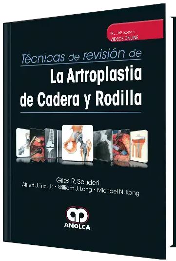 Técnicas de Revisión de la Artroplastia de Cadera y Rodilla