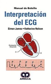 Manual de Bolsillo Interpretación del ECG