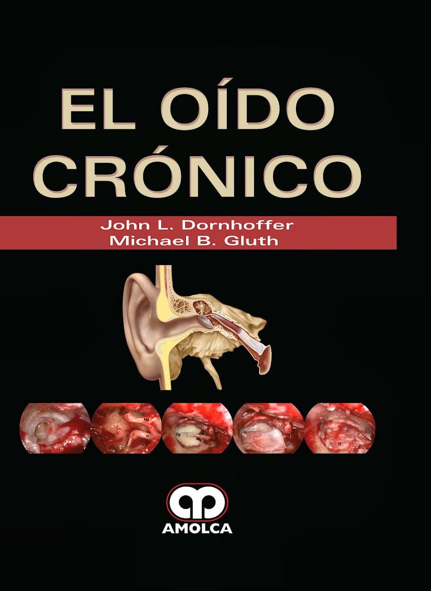 El Oído Crónico