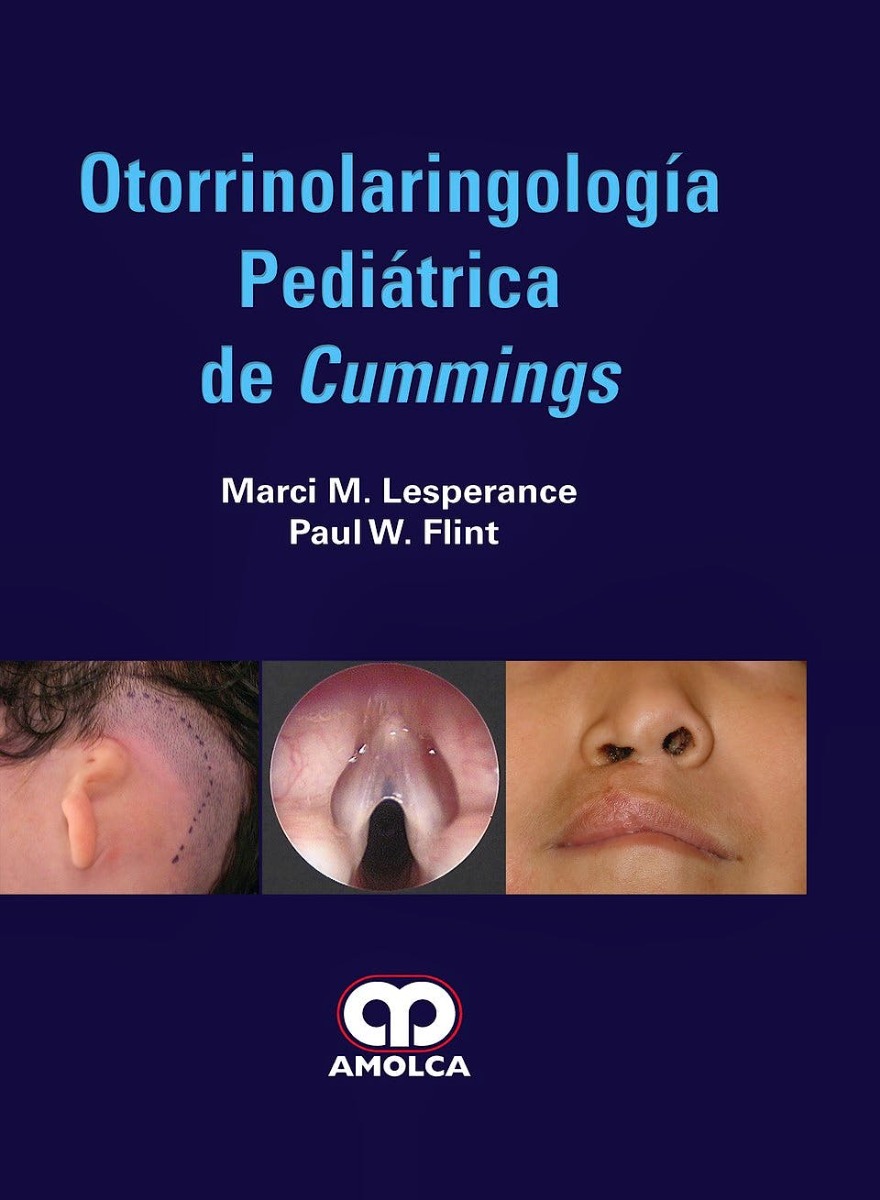 Otorrinolaringología Pediátrica de Cummings